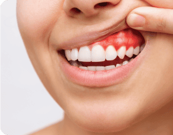 gum disease treatment