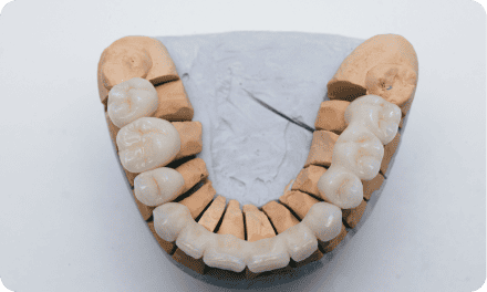 porcelain dental crowns