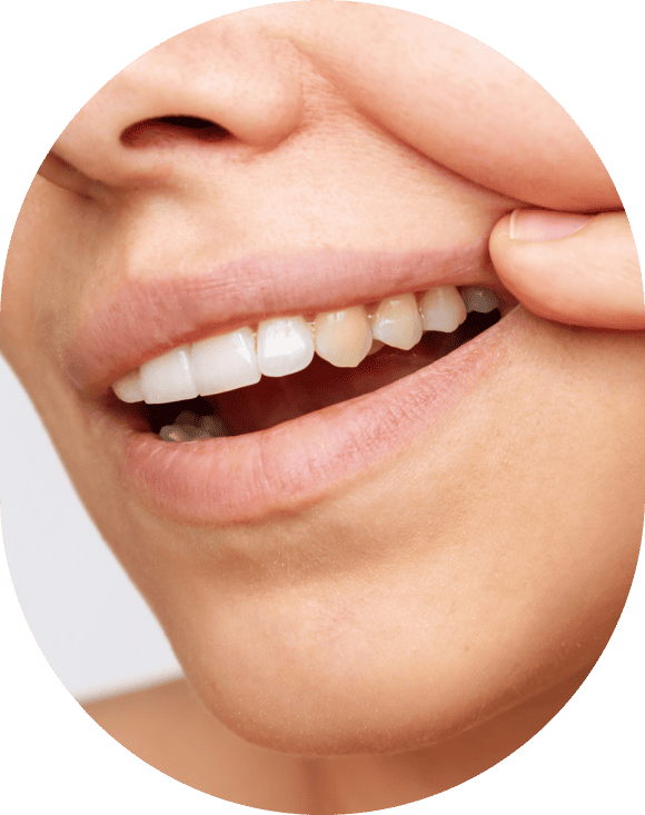 ultrasonic teeth cleaning